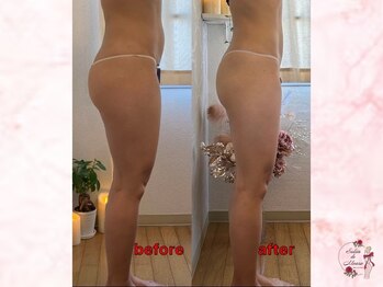 サロンドモアロ(Salon de Moaro)/Before/After