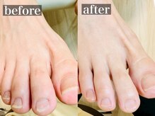 しあん 京都/爪を整えました。