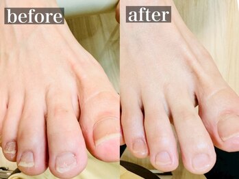 しあん 京都/爪を整えました。