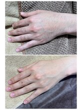 ビジュー(bjyou)/手の甲