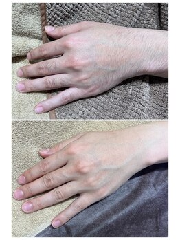 ビジュー(bjyou)/手の甲