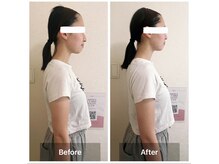 ラニ(Lani)/小顔美人整顔