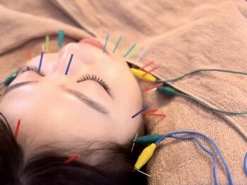 モッチ 天神大名店(MOCCHI)の写真/大切な日の前にメンテナンスをしたい方!!しっかりとカウンセリングを行いお悩み改善◎憧れの小顔へ♪