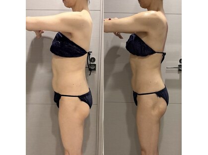 マテリアル(MATERIAL)の写真