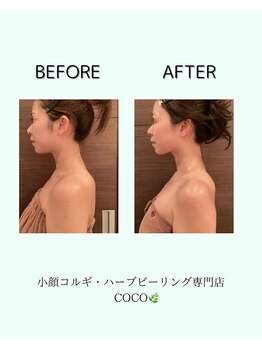 ココ 広島店(COCO)/ブライダルに選ばれる小顔コルギ