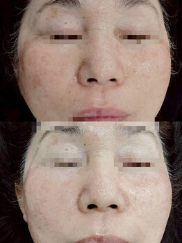 縁(en)/ポテンツァ継続の効果♪