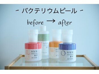 ミア(Mia)/バクテリウムピールフェイシャル