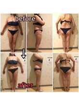 アンリール 旭川店(Anrire)/BODY施術のお客様です！