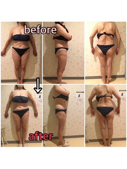 アンリール 旭川店(Anrire)/BODY施術のお客様です!