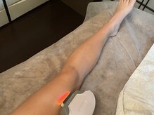 リフレ(Refre)/U24学割脱毛は大人の半額