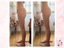 サロンドモアロ(Salon de Moaro)/Before/After