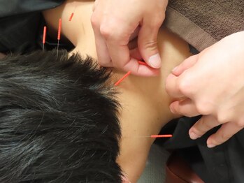サンテの写真/【大村希少★疼痛鍼灸】初回¥2000～!体の不調に根本からアプローチ◎鍼灸のプロがお悩みに寄り添い改善へ♪