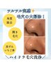 【毛穴の黒ずみ・ザラつき】"美容液でお肌を洗う" ハイドラ毛穴洗浄¥5,000