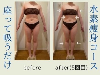 ヨサパーク レナータ(YOSA PARK Renata)/20代【痩身/小顔/美肌】5回