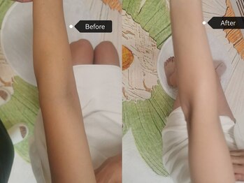 シークレット(Secret)/全身美白マシン