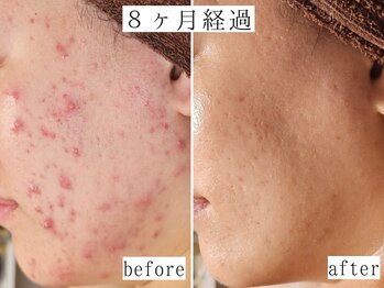 ユウビジン(YOU美人)/