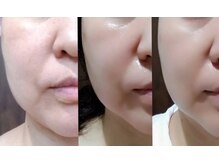 コールドゥ(Coeur-Doux)の雰囲気（肌老化が進む秋にSTOP！しっかりお手入れでいきいき肌に☆）