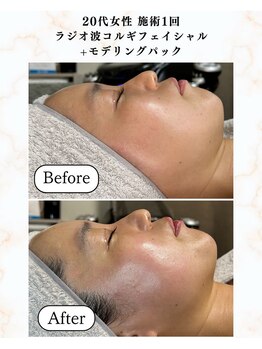 シーフェイス 横浜店(SEE FACE)/透明感アップでメイクのり改善