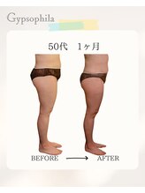 ジプソフィラ(Gypsophila)/痩身ビフォーアフター