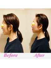 セルフィッシュ(Cellfish)/美容整体＆小顔矯正