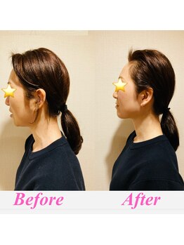 セルフィッシュ(Cellfish)/美容整体＆小顔矯正