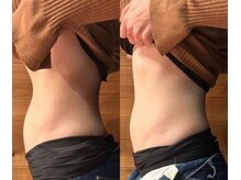 ビュウナ 銀座(BEAUNA)/ブライダル☆セレクトbody