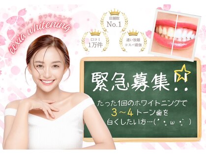 エクシアホワイトニング 西宮北口店の写真