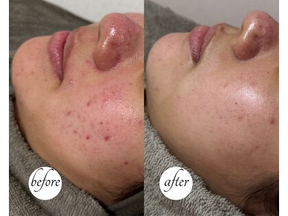 ルーム(lume)の写真