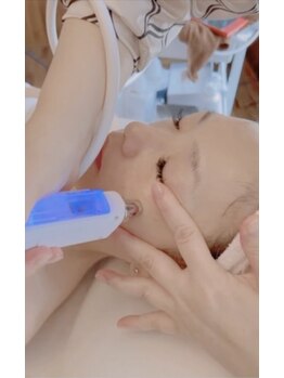 ラフォクシー(La.Foxy)/ヒト臍帯幹細胞導入コース