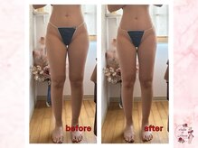 サロンドモアロ(Salon de Moaro)/Before/After