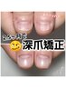 【深爪矯正】クリアジェル　メンズOK◎バレないマット仕上げも可能◎