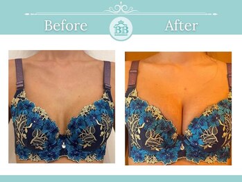 美人バスト 浜松店/◇ バストアップ &nbsp;BeforeAfter◇