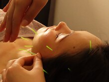 ソレイユ麻布鍼灸整体院の雰囲気（美容鍼＋ラジオ波フェイシャルで即効ツヤ肌◎浮腫、くすみにも◎）