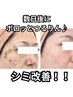 満足度NO.1★超短期集中【シミケア30分付エイジングフルコース】22000→12100