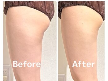 美活ラボ(美活LABO)/ビフォーアフター