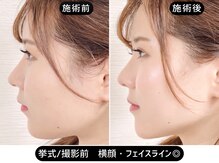 アオヤマ サロン ワイゼット(AOYAMA SALON YZ)