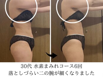 ヨサパーク タキ 上野毛(YOSA PARK TAKI)/30代・水素まみれコース6回