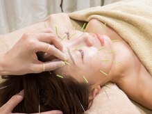 ハリツヤ(Hari艶)の雰囲気(優しい鍼でむくみを取ってすっきり小顔♪頬や目元のたるみに◎)