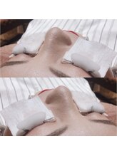 ジョリー(Jolie)/