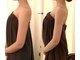 ビュールギンザ 静岡店(BeauL GINZA)の写真/二の腕＆背中のライン作りに♪すっきりほっそり美ボディラインをデザイン！短期集中ブライダルケアにも。