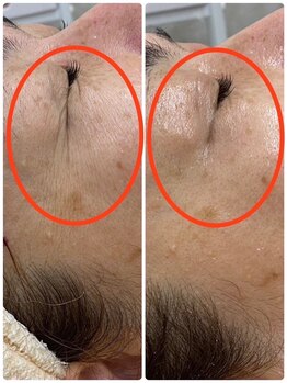 シャンティ(Shanti)/浜松市中区結果だし痩身専門店