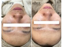 モンクラッシー(Mon classy)/1度の変化