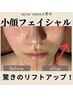 頭蓋骨小顔矯正と韓国で話題微細バリで小顔特化メニュー¥17,160→¥10,560