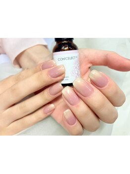 爪の悩みを解消できる（ケア含む）