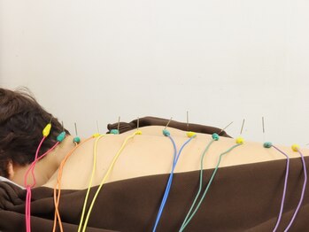 タピヨン 渋谷鍼療院(Tapiyon)の写真/神経根に届く本物の鍼施術。蓄積されたガチガチ首肩コリや息苦しさ改善！脊柱にダイレクトにアプローチ◎