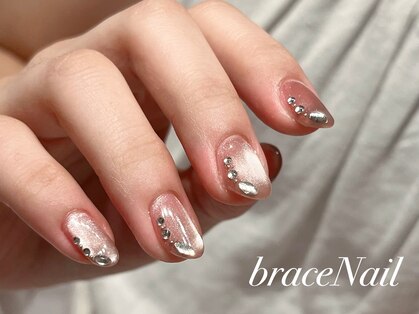 ブレスネイル(brace Nail)の写真
