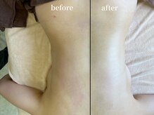 アンドゥ(Undo)/ゆがみを整える