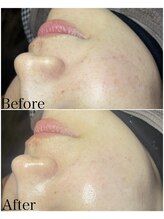 ブラックボックス(BLACK BOX)/30代女性のお客様