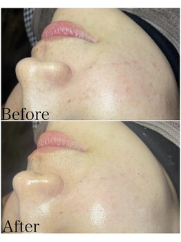 ブラックボックス(BLACK BOX)/30代女性のお客様