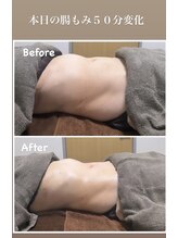 グレースヒーリング(GRACE HEALING)/本日の腸もみ